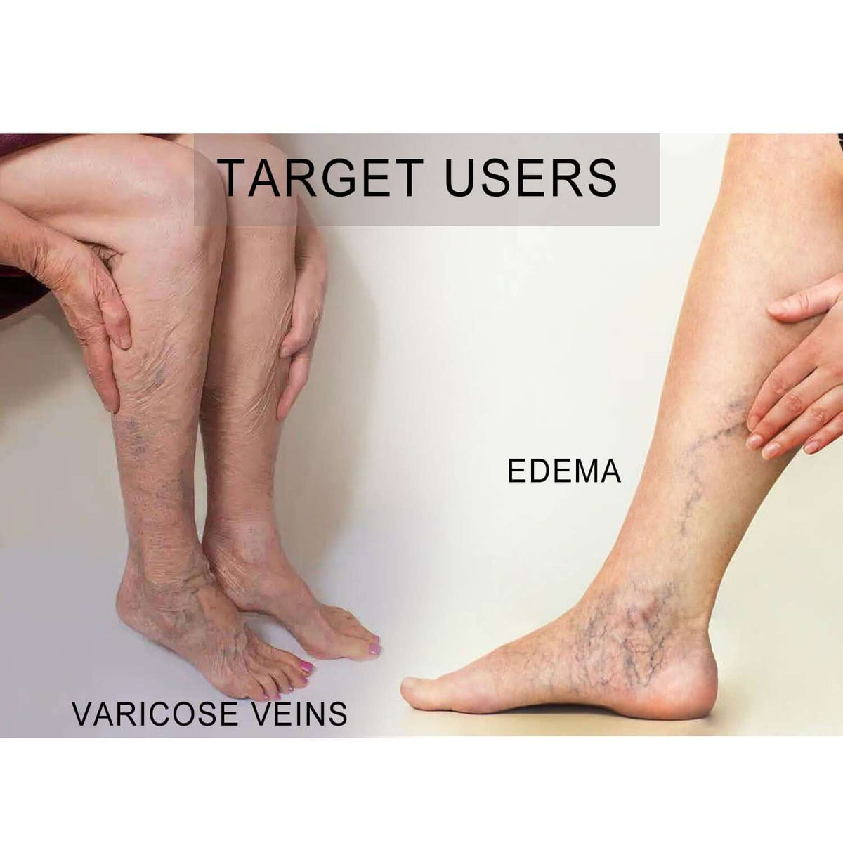 Open Toe Graduated Medical Compression Socks